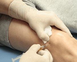 Infiltrazioni articolari palermo